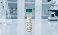 Lyophilized Bacterial EVs Derived from E. Coli (100µg vial)